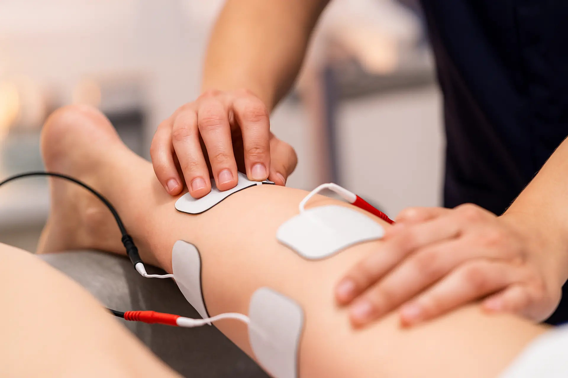 Tens Therapy for Sciatica